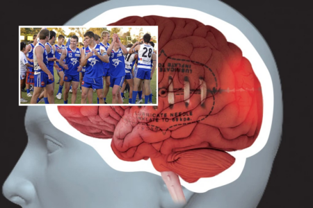 Bringing awareness to CTE after WAFL player robbed of his life