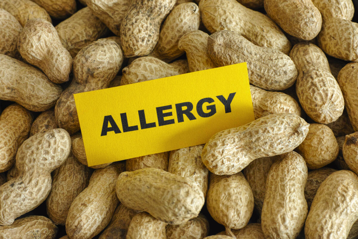 Article image for ‘Really exciting news’: Researcher sheds light on peanut allergy theory