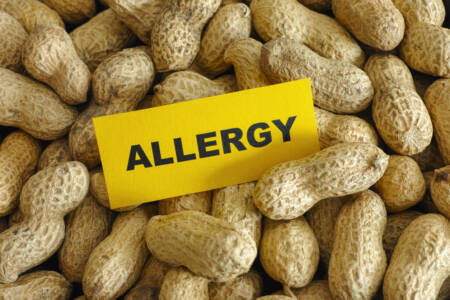 ‘Really exciting news’: Researcher sheds light on peanut allergy theory