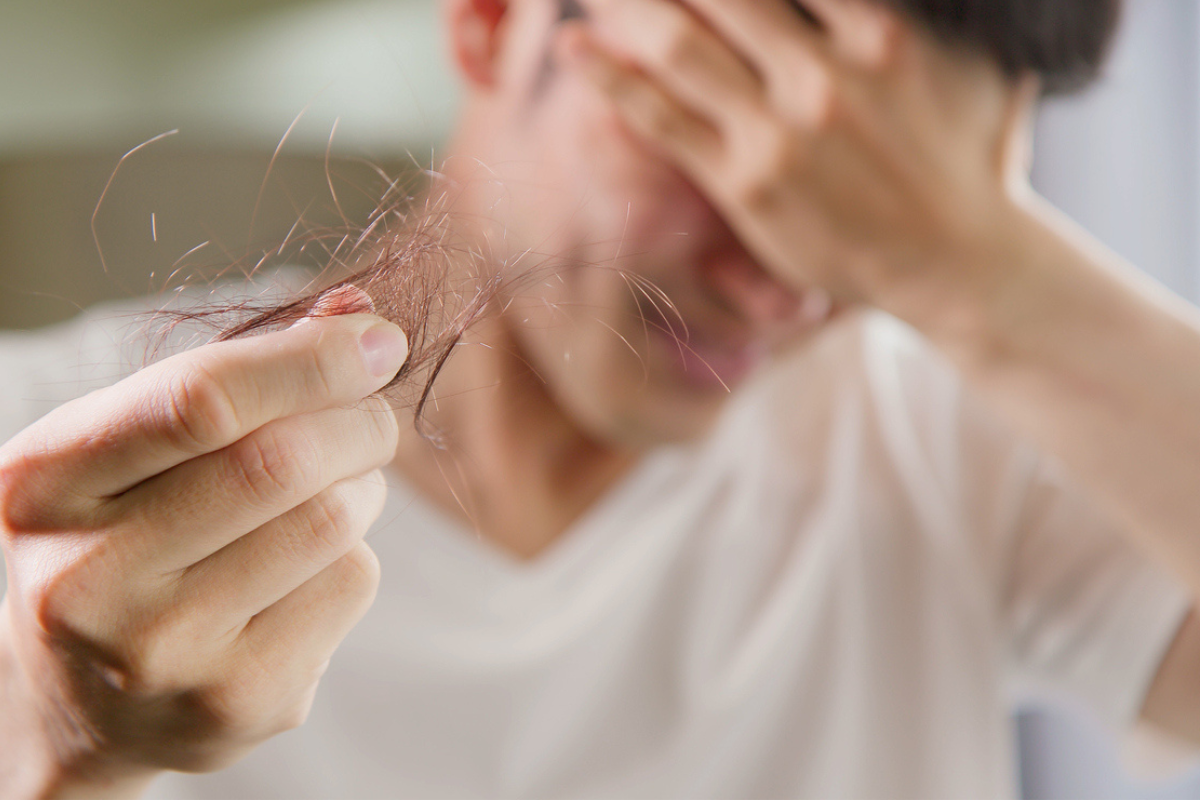 Article image for Medical professionals warning against travelling to Turkey for hair transplants