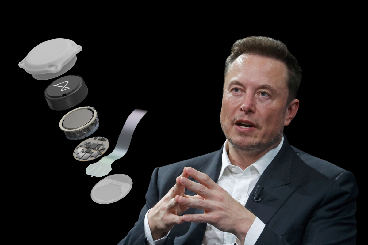 Article image for Elon Musk’s brain implant approved for human trials