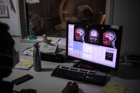 New research suggests MRI scans may help predict dementia